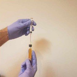 PRP Procedure – 1 PRP Procedure - 1